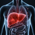 hepatitis